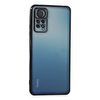 Xiaomi Redmi Note 11 Pro Kılıf Razer Lensli Silikon - Siyah TdrTR