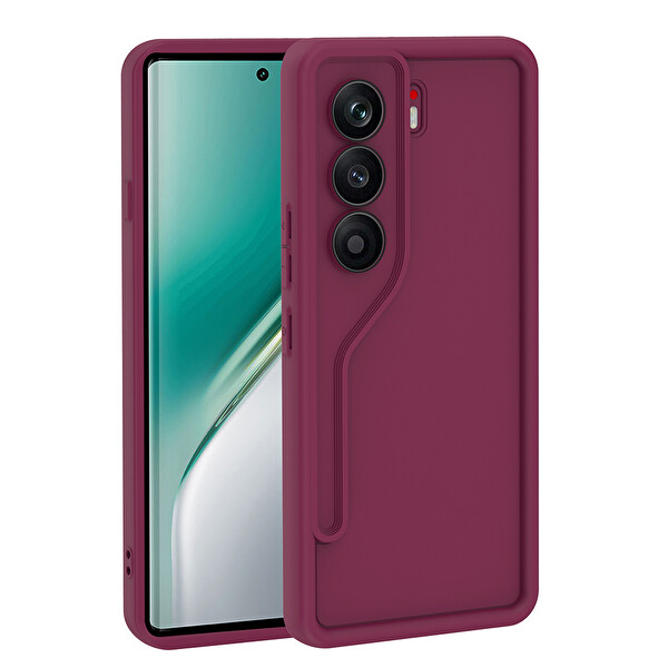 Başkenttekno Tecno Camon 40 Pro Kılıf Kamera Korumalı Ananas Kapak