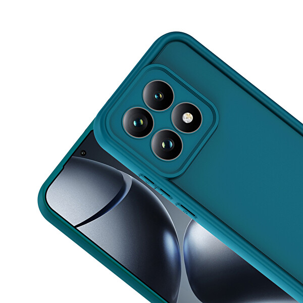 Başkenttekno Xiaomi 15T Uyumlu Kılıf Kamera Korumalı Ananas Kapak Koyu Yeşil
