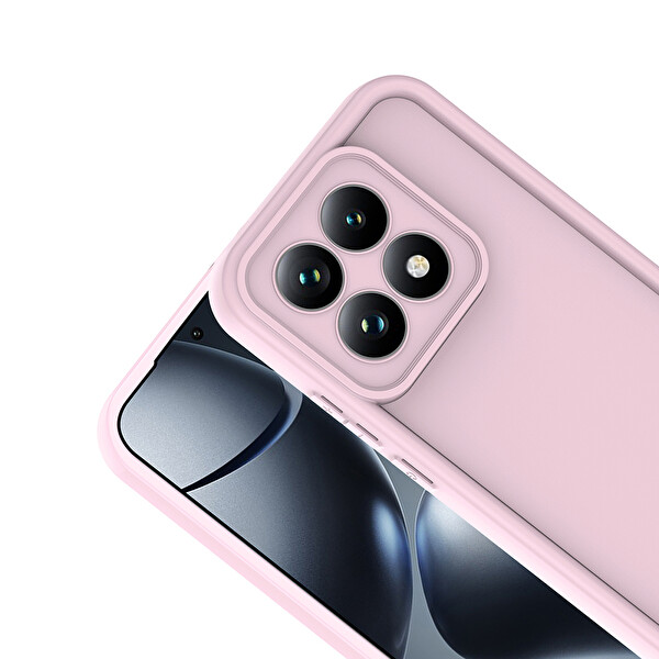 Başkenttekno Xiaomi 15T Uyumlu Kılıf Kamera Korumalı Ananas Kapak Pembe