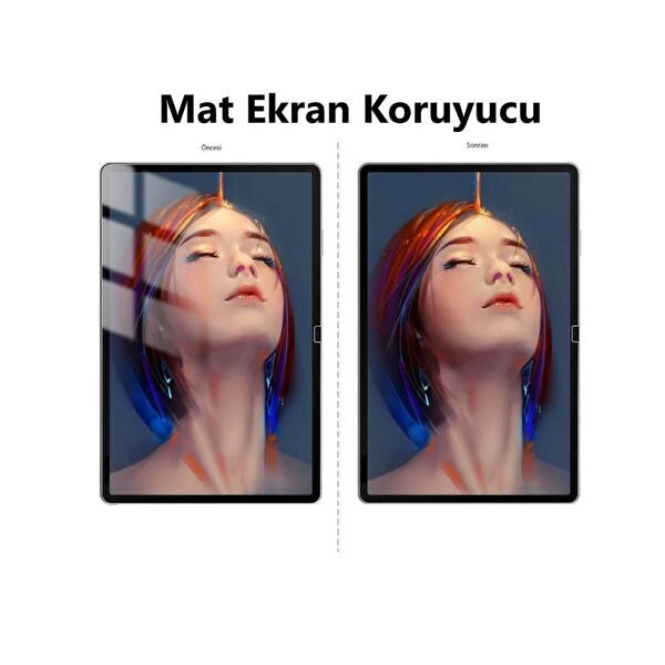Engo Lenovo Tab M8 Gen 4 Uyumlu 9H Nano Şeffaf 8