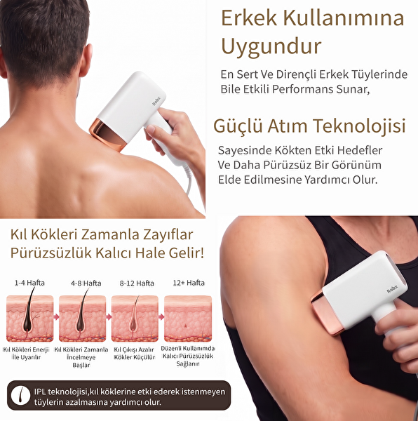 Robx A2024 Yeni Nesil Buz Soğutmalı Ağrısız IPL Lazer Epilasyon Cihazı