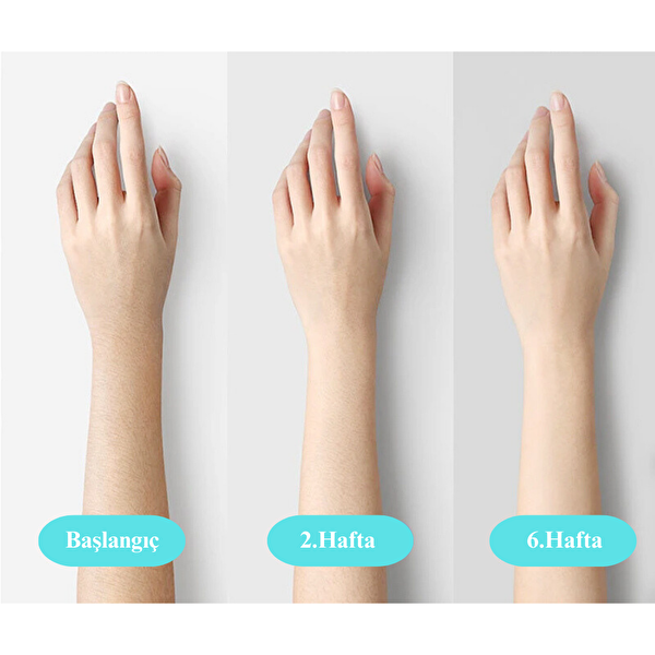 Yui IPLV16 Pro Ağrısız Otomatik ve Manuel Atım Buz Lazer Epilasyon Cihazı - Beyaz