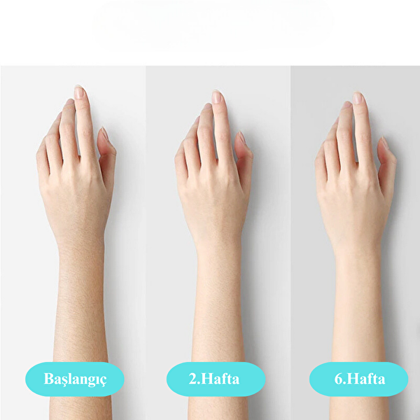 Yui IPLV15 Pro Vücut Yüz Bikini Başlıklı Ağrısız Otomatik ve Manuel Atım Buz Lazer Epilasyon Cihazı - Siyah