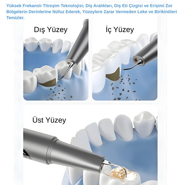 NPO M1 5MP Kameralı UV'li 5 Modlu Ultrasonic Tartar Plak PET Diş Temizleme Cihazı