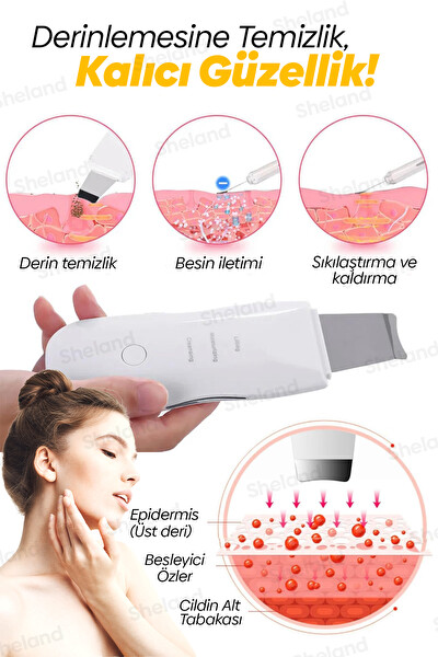 Sheland Ultrasonik Yüz Spatulası Siyah Nokta Giderici