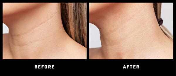 Foreo FAQ 211 Yaşlanma Karşıtı Boyun ve Dekolte LED Maskesi