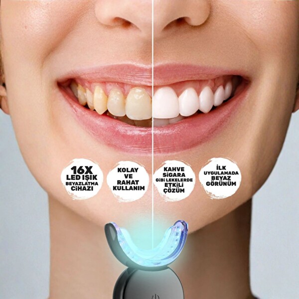 NPO IL32 Mavi Kırmızı Işık Teknolojili 32 Ledli 3 Beyazlatma Jelli Hızlı Diş Beyazlatma Kiti