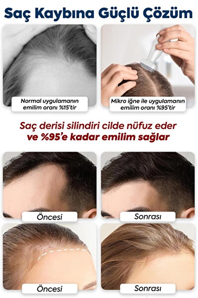 Sheland 120 Titanyum İğneli 30 ml Collagen Serum Ayarlanabilir İğne Ölçülü 0.25–2.0 mm Dermastamp