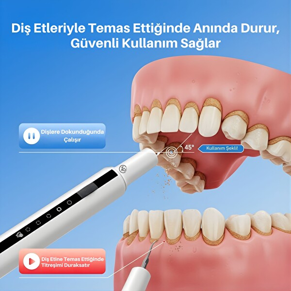NPO T7 Smart 5 Modlu Ultrasonic Diş Beyazlatma Tartar Plak Diş Taşı Temizleme Cihazı