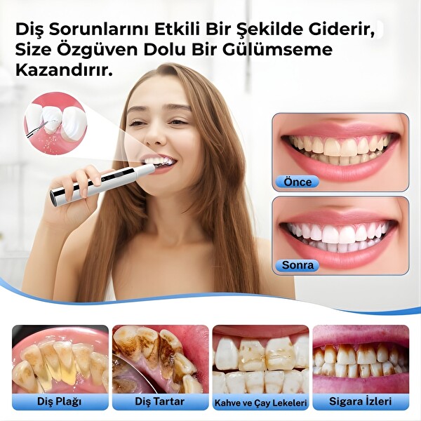 NPO T7 Smart 5 Modlu Ultrasonic Diş Beyazlatma Tartar Plak Diş Taşı Temizleme Cihazı