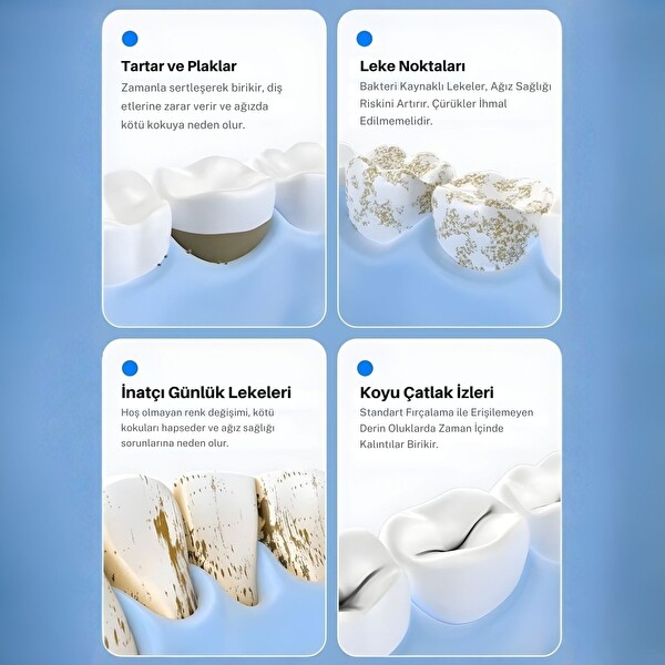 NPO T7 Smart 5 Modlu Ultrasonic Diş Beyazlatma Tartar Plak Diş Taşı Temizleme Cihazı