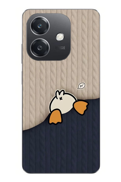 Le Balvo Oppo A3 Uyumlu Şaşkın Ördek Baskılı Silikon Kılıf